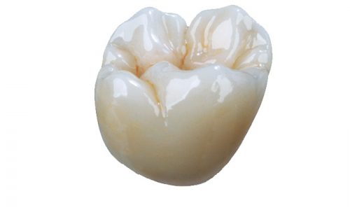 Full-Contour-Zirconia-wh